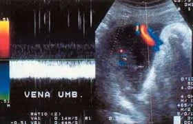 Imagen de referencia de perfil hemodinámico fetal publicada en la web de Natal Médica